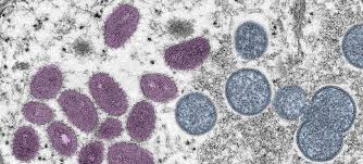 New recombinant mpox strain detected in UK and India, WHO urges continued monitoring