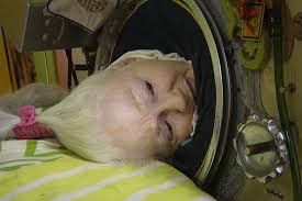 Last Iron Lung User Dies: Polio Survivor Martha Lillard’s Final Crisis Exposes a Vanishing Legacy