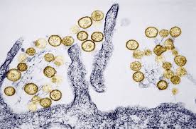 Hanta Virus