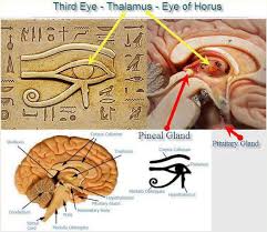 Image result for pineal gland calcification