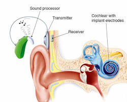 قوقعة الأذن