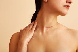 Image result for scars