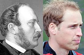 High-profile: William can blame his hairline on greatgreatgreat-great-grandfather Prince Albert (1819-1861) - article-1222921-06F63D01000005DC-440_634x423