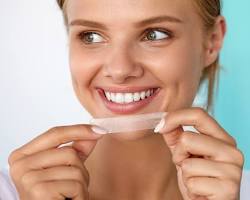 Image of Athome teeth whitening