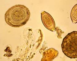 Image of Parasitology