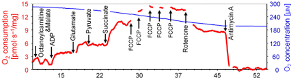 Mitochondrial Dysfunction as a Key Predictor of Severity in Gulf War Illness: Insights from Scientific Reports - 1