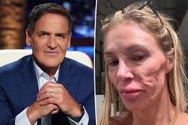 Why Brandi Glanville turned to Mark Cuban’s company for help with medication costs from facial disfigurement
