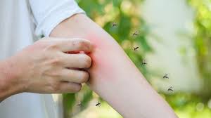 ¡Adiós Mosquitos! El Secreto Natural que NO Quieren que Sepas en Perú - Imagen ilustrativa del artículo