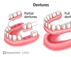 Dental prosthesis
