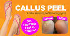 Callus peel