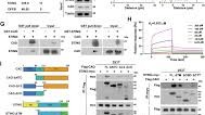 CAD hijacks STING to impair antitumor immunity and radiotherapy efficacy of colorectal cancer