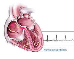 person's heart with an irregular heartbeatの画像