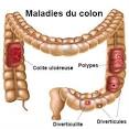 Coliques du nourrisson : en reconnatre les symptmes, trouver le