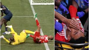 ¡ALARMA en Bayern! Estrella sufre escalofriante fractura: ¿Adiós al Mundial? - Imagen principal del artículo