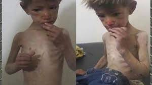 Resultado de imagen de madaya syria