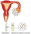 Inseminations artificielles