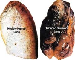 Image result for smoking effects