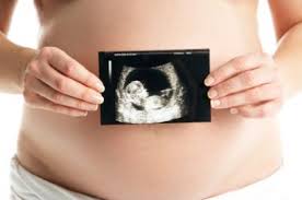 Resultado de imagen de bebe embarado