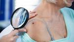  7 subtle skin cancer warning signs you need to know about