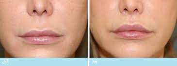 تصویر مرتبط