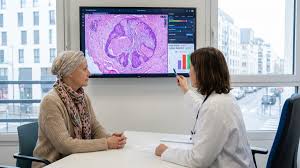 Finies les chimiothérapies inutiles ? Cette IA révolutionnaire bouleverse le traitement du cancer du sein