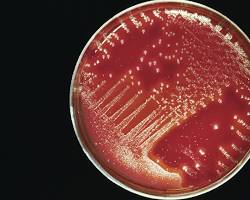 Obraz: petri dish with bacterial culture