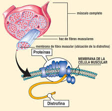 Resultado de imagen de distrofia muscular de duchenne