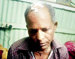 Ramesh Gurav, who intervened, sustained head injuries after the group assaulted him - Ramesh-Gurav