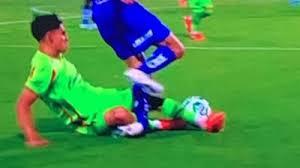 ¡Imágenes sensibles! Alan Medina sufre fractura de tobillo en el Pumas vs FC Juárez (FOTO)