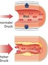 Hypertonie bluthochdruck