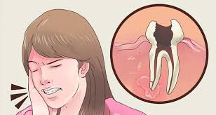 Image result for toothache