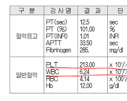 ANC 수치 계산