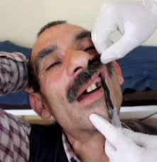 Karabekir mahallesinde ikamet eden Hüseyin Taşkın (46) dişlerinin hep çürüyerek köklerinin kaldığını belirterek sürekli sorun yaşadığını belirtti. - 646064_detay