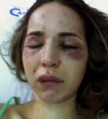 Resultado de imagen de mujeres maltratadas