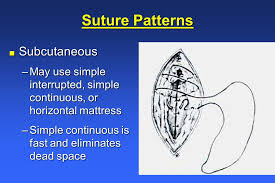 Image result for simple continuous suture pattern