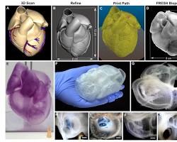 3D printing for surgery invention