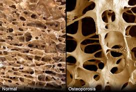 Image result for bones