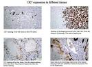 Keratin immunohistochemistry in normal human liver. Cytokeratin