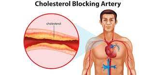Resultado de imagen de colesterol