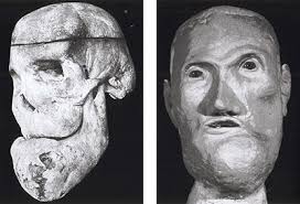 Der von Hyperostose verwachsene Schädel von Thomas Hasler und eine Gesichtsnachbildung - beide Abbildungen aus &quot;Schädel-Schicksale historischer ... - Thomas_Hasler