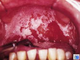 images?q=tbn:ANd9GcSnpC8JjZ0tScYSbhaVi90Fkm pUCfyqOyzn50yEfCKjCq QVzVJg