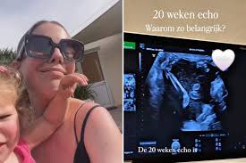 BV Hotspot. Eline De Munck krijgt klappen en Candice Martens deelt haar 20-wekenecho