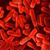 Patient tests positive for Legionella at Brisbane's Mater Private ...