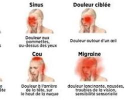 Maux de tête