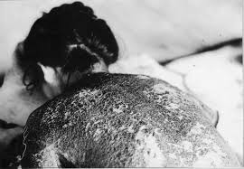 Image result for hiroshima death