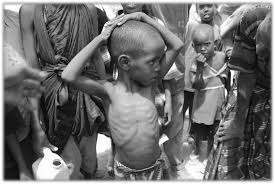 Image result for Starving 3rd world children