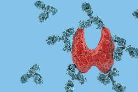 Hashimoto's Disease: Symptoms , Diagnosis & treatment - Dr ...