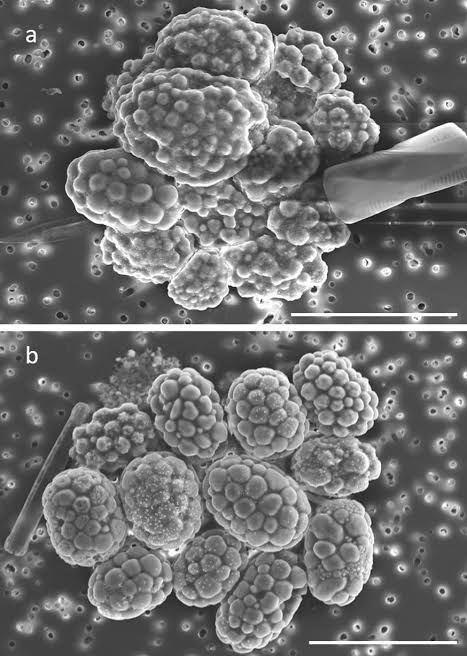 Intracellular calcite and sulfur dynamics of Achromatium cells observed in a lab-based enrichment and aerobic incubation experiment | Antonie van Leeuwenhoek