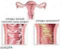 Gravid og sopp i underlivet