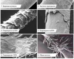 Изображение: Кутикула волоса